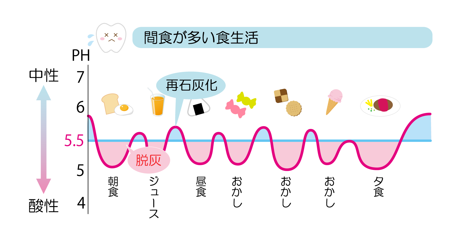 綾瀬の歯医者、新井歯科医院のむし歯治療
