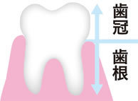 足立区綾瀬の歯医者 新井歯科医院 歯の破折