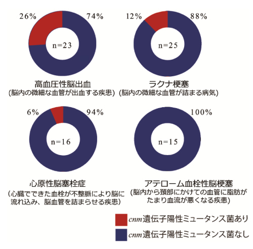 足立区綾瀬の歯医者　新井歯科医院　むし歯菌と脳卒中との関連が明らかに