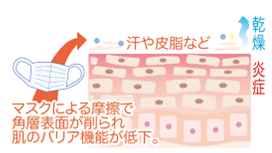 摩擦