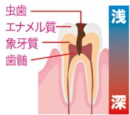進行レベル
