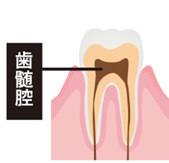 歯髄腔"