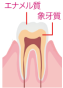 断面