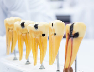 綾瀬の歯医者、新井歯科医院で、更年期女性に多い口腔トラブルについての解説