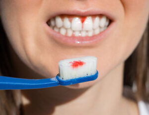 綾瀬の歯医者、新井歯科医院で、更年期女性に多い口腔トラブルについての解説