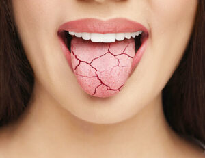 綾瀬の歯医者、新井歯科医院で、更年期女性に多い口腔トラブルについての解説