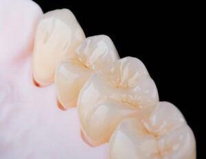 綾瀬の歯医者、新井歯科医院で、根管治療で通院間隔が空いてしまった！対処法やリスクを解説