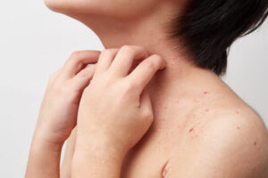 綾瀬の歯医者、新井歯科医院で、根管治療で通院間隔が空いてしまった！対処法やリスクを解説