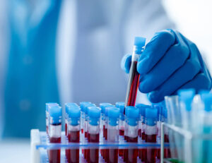 綾瀬の歯医者、新井歯科医院で、根管治療で通院間隔が空いてしまった！対処法やリスクを解説