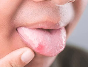 綾瀬の歯医者、新井歯科医院で、根管治療で通院間隔が空いてしまった！対処法やリスクを解説