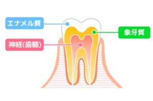 綾瀬の歯医者、新井歯科医院で、歯の神経を抜くとどうなる？根管治療後の歯の寿命とセルフケア方法を解説